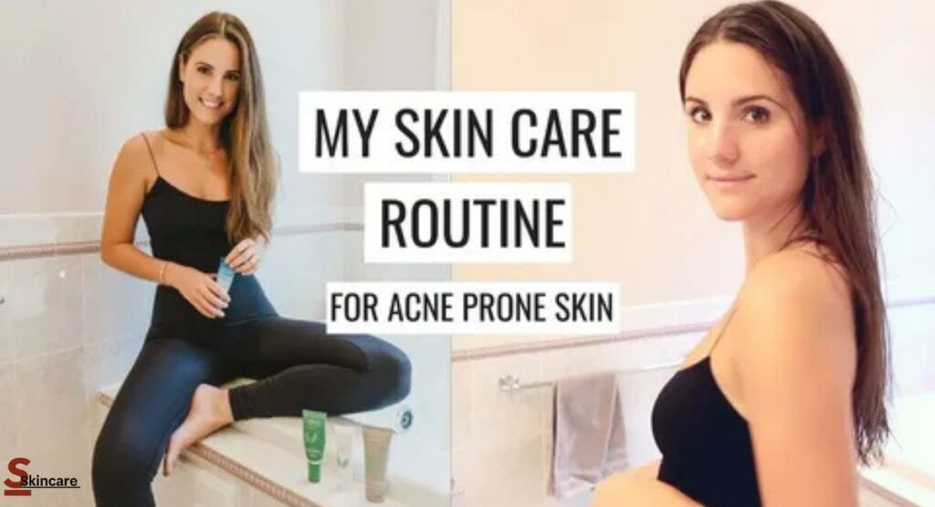 is pdrn skincare safe for acne prone skin